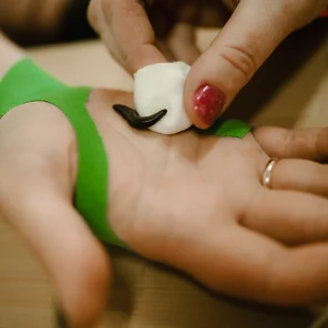 Гирудопрактика